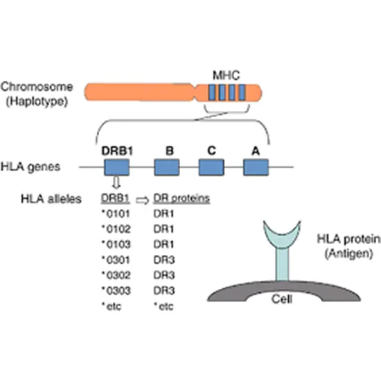 HLA Typing-Molecular B5 Locus
